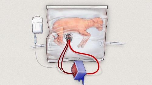 Researchers Create An Artificial Womb To Grow Preterm Lambs